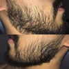 12.5% Minoxidil Customer review by Morgan from the USA
